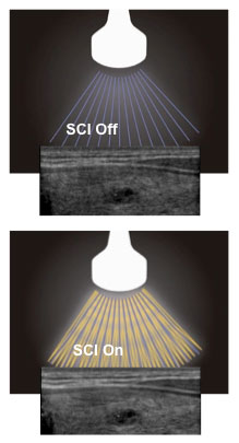 ProSound F75 Spatial Compound Imaging (SCI)